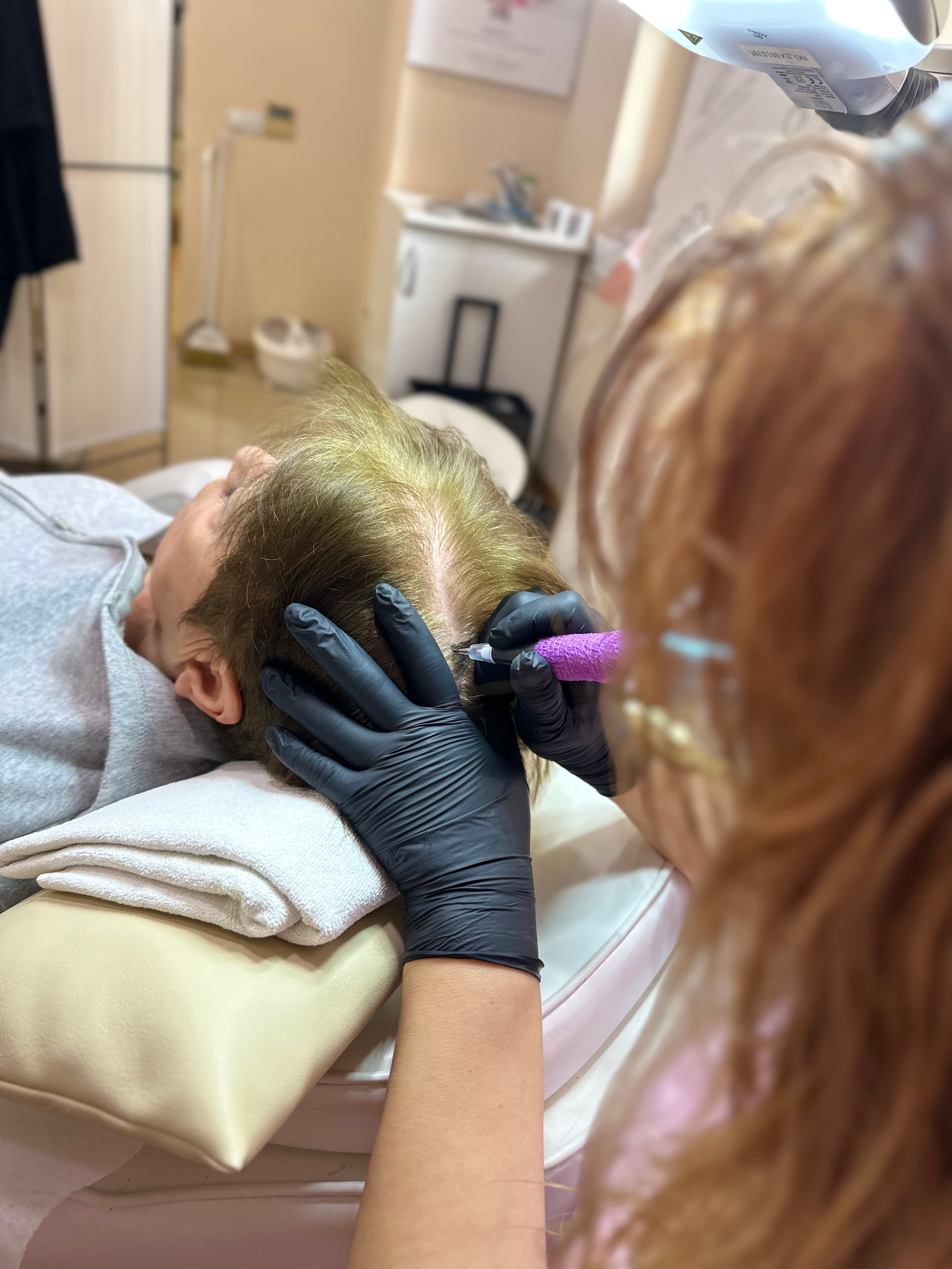 scalp pigmentation training